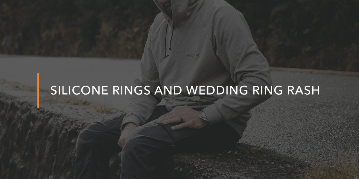 wedding ring rash