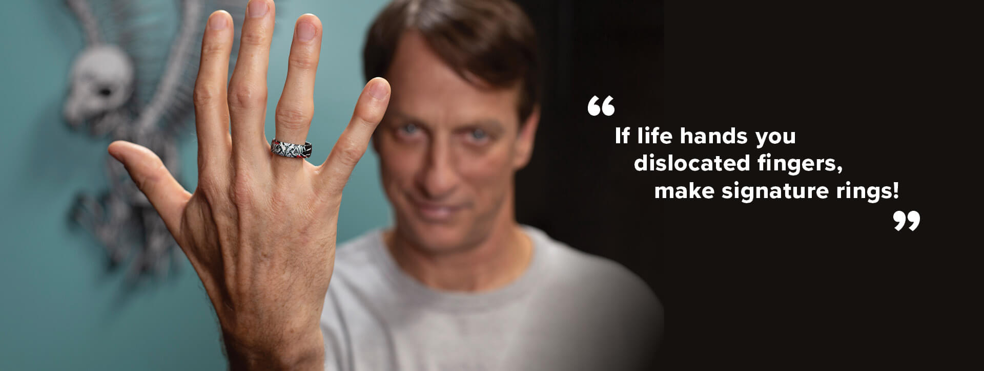 Tony Hawk posing with Falcon 3 ring on his finger, If life hands you dislocated fingers, make signature rings!